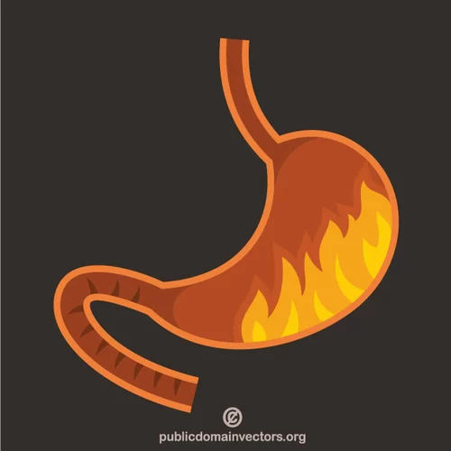 Heartburn health condition